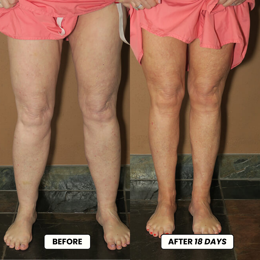 Lymphdrainage-Tropfen