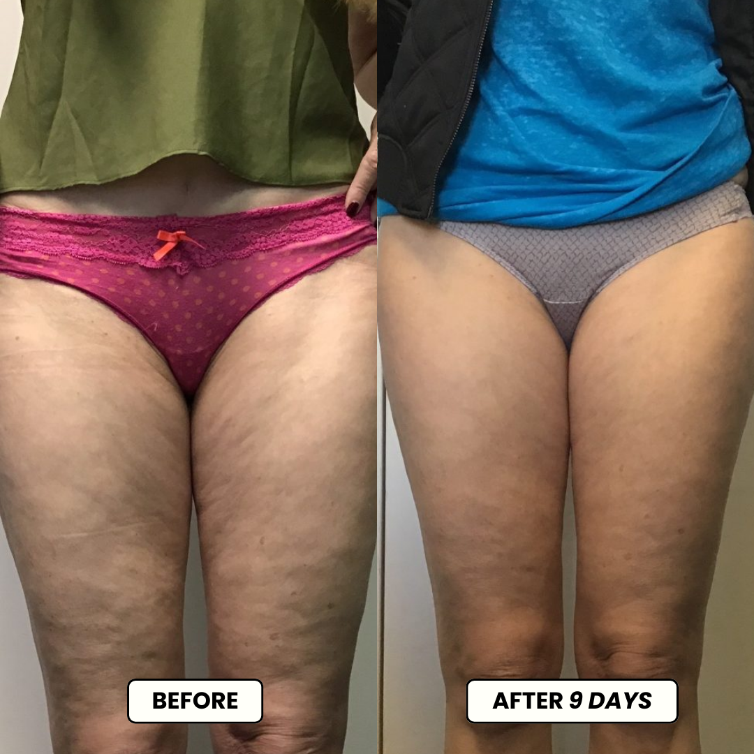 Lymphdrainage-Tropfen