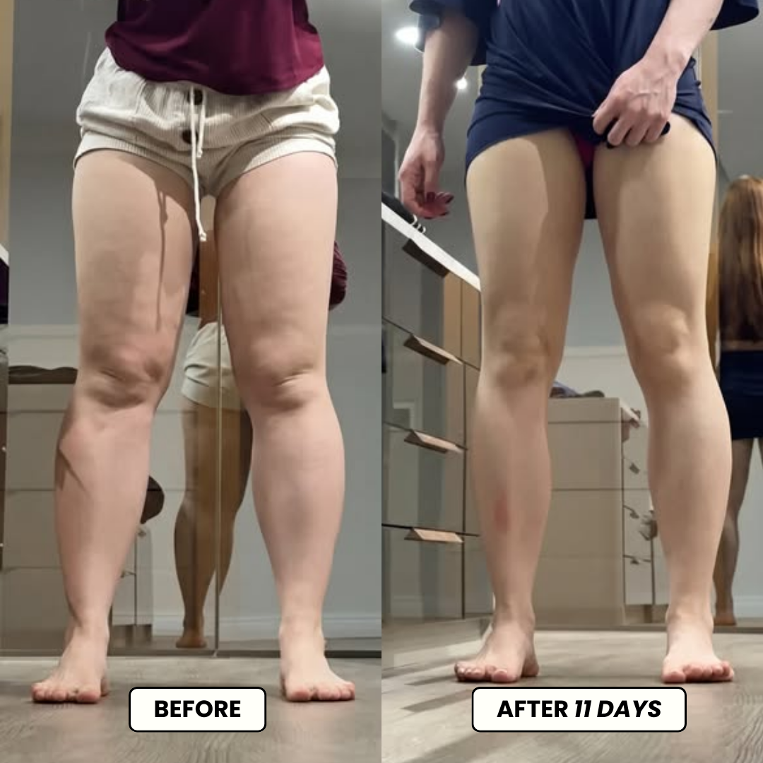 Lymphatic Drainage Drops