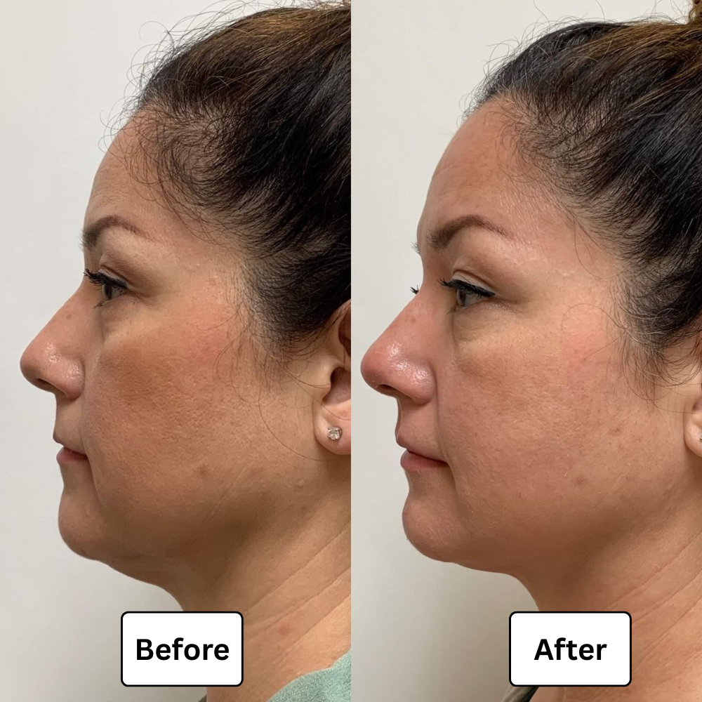Lymphdrainage-Tropfen