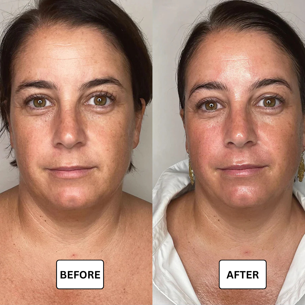 Lymphdrainage-Tropfen