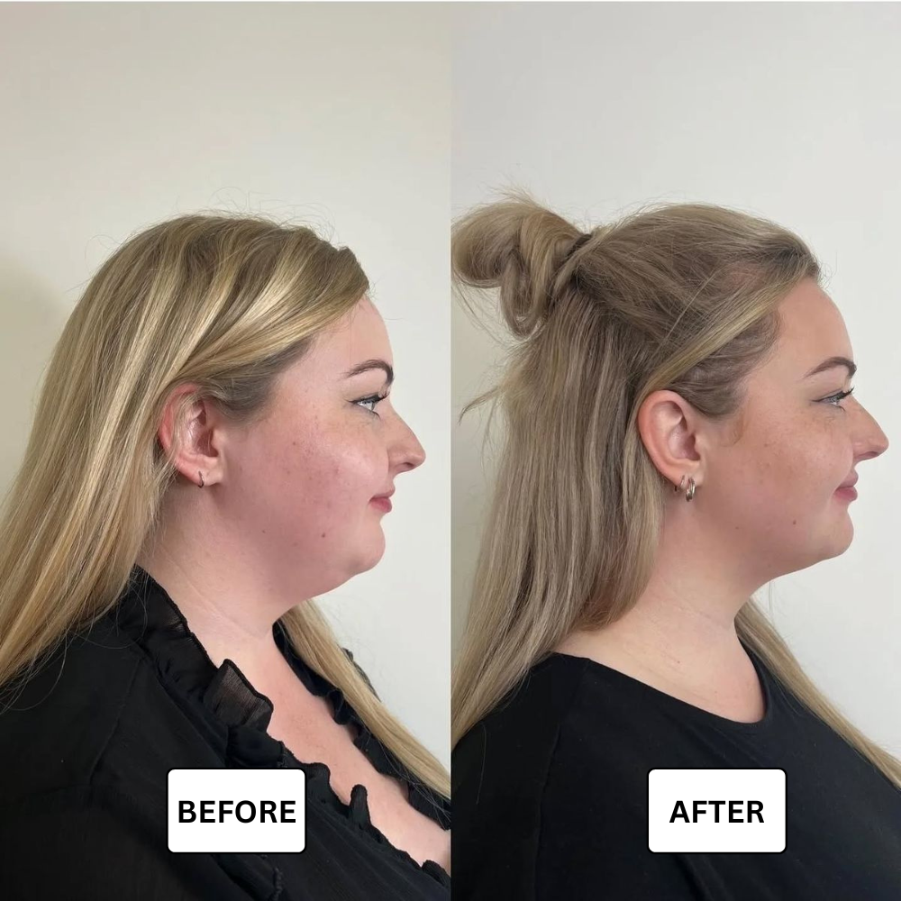 Lymphdrainage-Tropfen