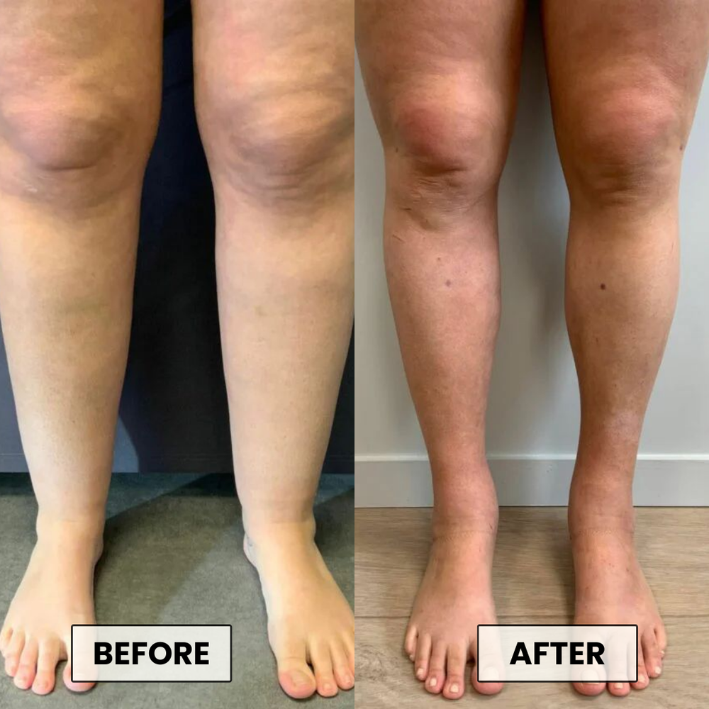 <p>Gentle, Easy, Noticeable Results</p>