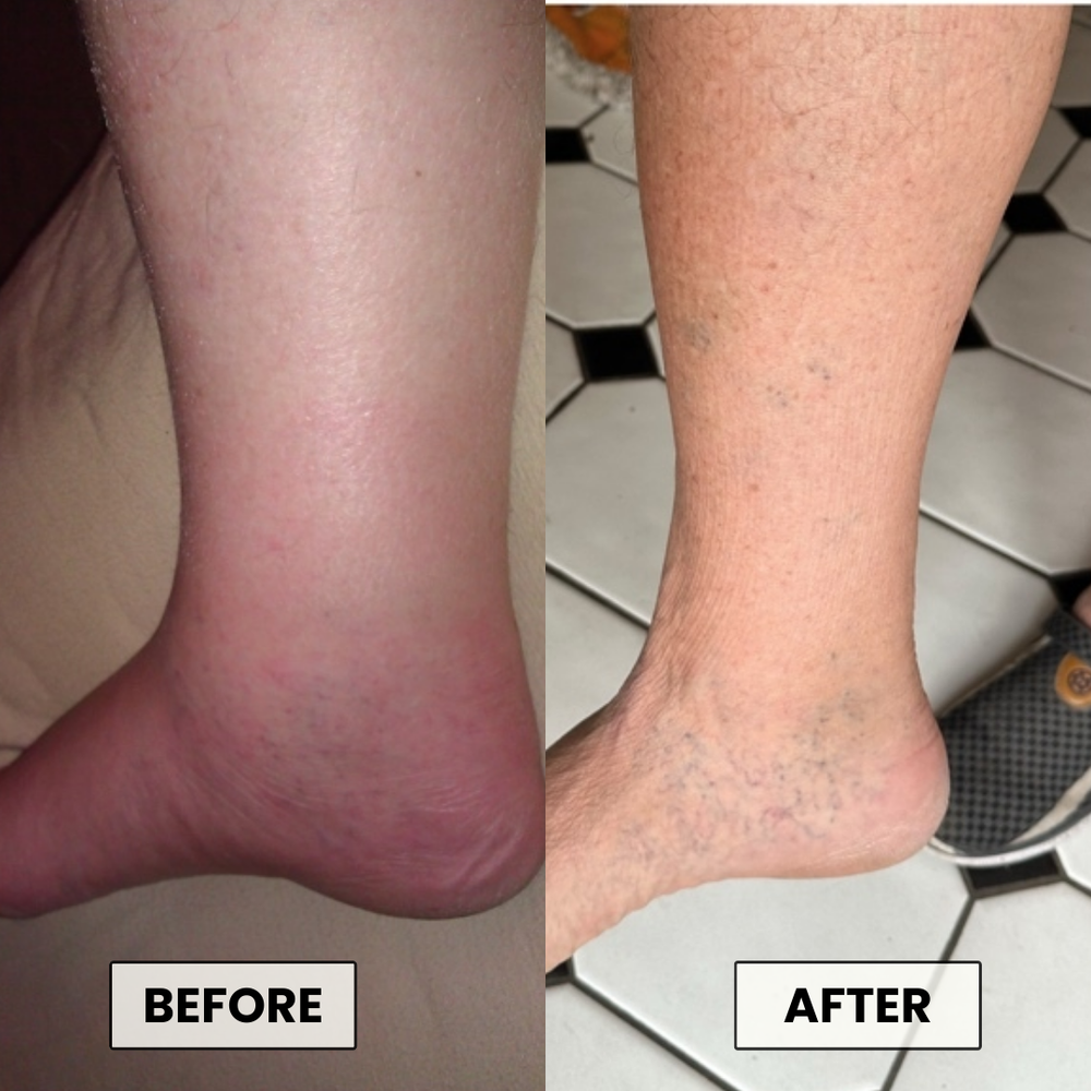 <p>Gentle, Easy, Noticeable Results</p>